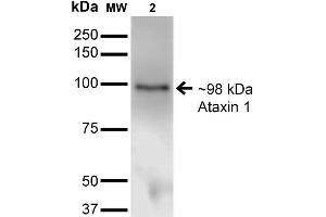Western Blot analysis of Monkey COS-1 cells transfected with Ataxin- 1 showing detection of ~85 kDa Ataxin 1 protein using Mouse Anti-Ataxin 1 Monoclonal Antibody, Clone S65-37 . (Ataxin 1 anticorps  (AA 746-761) (PerCP))