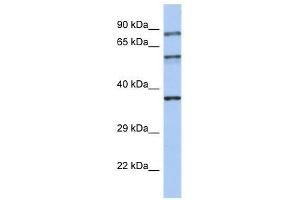 Western Blot showing RPH3A antibody used at a concentration of 1-2 ug/ml to detect its target protein. (RPH3A anticorps  (N-Term))