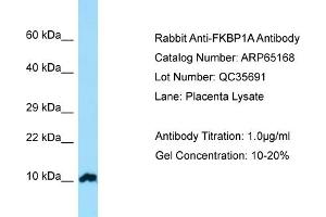 Western Blotting (WB) image for anti-FK506 Binding Protein 1A, 12kDa (FKBP1A) (N-Term) antibody (ABIN2790065) (FKBP1A anticorps  (N-Term))