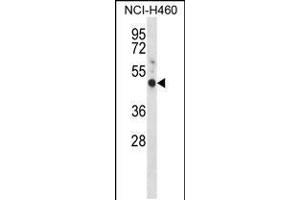Western blot analysis in NCI-H460 cell line lysates (35ug/lane). (GYPE anticorps  (C-Term))