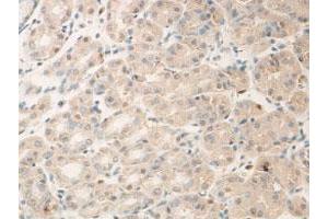 Immunohistochemical staining of formalin-fixed paraffin-embedded human stomach showing membrane staining with ADAM15 polyclonal antibody  at 1:100 dilution. (ADAM15 anticorps)