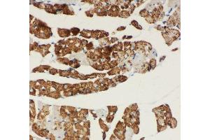 Anti-NDUFA1 antibody, IHC(P) IHC(P): Rat Cardiac Muscle Tissue (NDUFA1 anticorps  (C-Term))