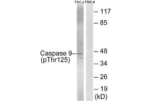 Western blot analysis of extracts from HeLa cells, treated with TNF (20ng/ml, 5mins) and calyculinA (50ng/ml, 15mins), using Caspase 9 (Phospho-Thr125) antibody. (Caspase 9 anticorps  (pThr125))