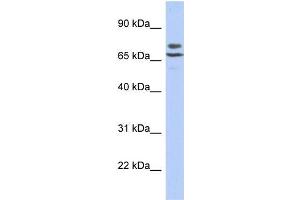 Human SH-SYSY; WB Suggested Anti-C3orf39 Antibody Titration: 0. (C3orf39 anticorps  (N-Term))
