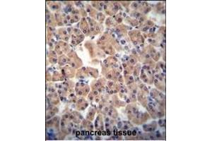 ATPBD3 antibody (Center) (ABIN654307 and ABIN2844091) immunohistochemistry analysis in formalin fixed and paraffin embedded human pancreas tissue followed by peroxidase conjugation of the secondary antibody and DAB staining.