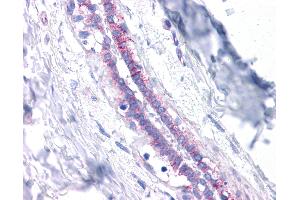 Anti-E Cadherin antibody IHC of human breast. (E-cadherin anticorps  (AA 503-552))