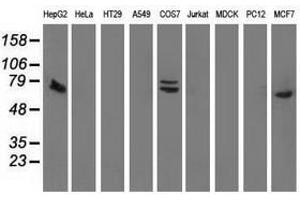 Image no. 3 for anti-SAM Domain and HD Domain 1 (SAMHD1) antibody (ABIN1500800) (SAMHD1 anticorps)