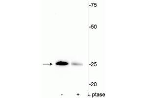 Western blot of mouse heart lysate showing specific immunolabeling of the ~25 kDa cardiac troponin I protein phosphorylated at Ser43 in the first lane (-). (TNNI3 anticorps  (pSer43))