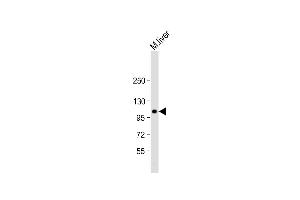 Anti-GART Antibody (C-Term) at 1:2000 dilution + mouse liver lysate Lysates/proteins at 20 μg per lane. (GART anticorps  (AA 672-703))