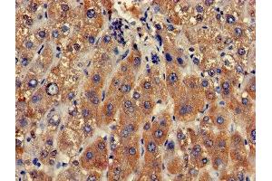 Immunohistochemistry of paraffin-embedded human liver tissue using ABIN7147821 at dilution of 1:100 (Clarin 2 anticorps  (AA 31-100))