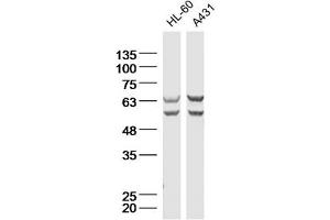 Lane 1: HL-60 Cell lysates; Lane 2: A431 Cell lysates; probed with Natriuretic Peptide Receptor C Polyclonal Antibody, unconjugated (bs-2333R) at 1:300 overnight at 4°C followed by a conjugated secondary antibody for 60 minutes at 37°C. (NPR3 anticorps  (AA 301-400))