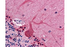 Anti-CORO1B antibody IHC of human brain, cerebellum.