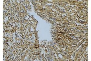 ABIN6273022 at 1/100 staining Mouse kidney tissue by IHC-P.