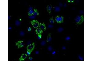 Immunofluorescence (IF) image for anti-Aconitase 2, Mitochondrial (ACO2) antibody (ABIN1496411) (ACO2 anticorps)