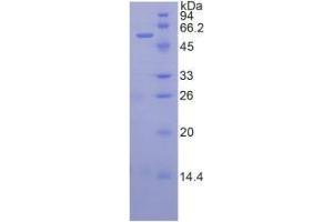 SDS-PAGE analysis of Human TFPI Protein. (TFPI Protéine)