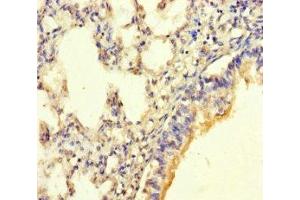 Immunohistochemistry of paraffin-embedded human lung tissue using ABIN7165887 at dilution of 1:100 (SGK196 anticorps  (AA 44-350))