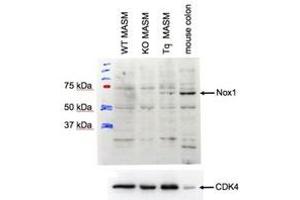Western Blotting (WB) image for anti-NADPH Oxidase 1 (NOX1) (Internal Region) antibody (ABIN2464425) (NOX1 anticorps  (Internal Region))
