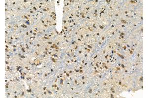 ABIN6260275 and ABIN6276295 at 1/100 staining Rat brain tissue by IHC-P.