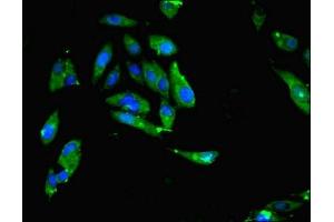 Immunofluorescent analysis of Hela cells using ABIN7159642 at dilution of 1:100 and Alexa Fluor 488-congugated AffiniPure Goat Anti-Rabbit IgG(H+L)