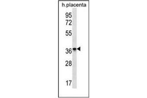 Western blot analysis of OR8D4 Antibody (C-term) Cat.