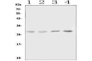 Western blot analysis of Oncostatin M using anti-Oncostatin M antibody (ABIN6719351).