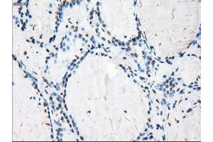 Image no. 4 for anti-P450 (Cytochrome) Oxidoreductase (POR) antibody (ABIN1497746) (POR anticorps)