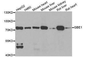 Western blot analysis of extracts of various cell lines, using GBE1 antibody. (GBE1 anticorps  (AA 1-300))