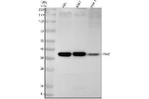 Western blot analysis of PIM2 using anti-PIM2 antibody (ABIN7605955).