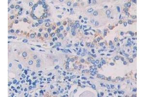 Detection of MAPRE1 in Human Kidney Tissue using Polyclonal Antibody to Microtubule Associated Protein RP/EB Family, Member 1 (MAPRE1)