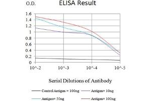 Black line: Control Antigen (100 ng),Purple line: Antigen (10 ng), Blue line: Antigen (50 ng), Red line:Antigen (100 ng)