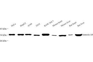 Western blot analysis of Annexin-A4 (ABIN7073066) at dilution of 1: 500 (Annexin IV anticorps)