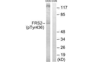 Western blot analysis of extracts from COS cells, using FRS2 (Phospho-Tyr436) antibody. (FRS2 anticorps  (pTyr436))
