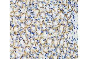 Immunohistochemistry of paraffin-embedded Rat kidney using COMT Polyclonal Antibody at dilution of 1:100 (40x lens). (COMT anticorps)