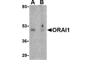 Western Blotting (WB) image for anti-ORAI Calcium Release-Activated Calcium Modulator 1 (ORAI1) (N-Term) antibody (ABIN1031496)