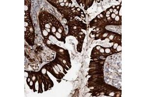 Immunohistochemical staining of human colon with CGN polyclonal antibody  shows strong cytoplasmic and membranous positivity in glandular cells at 1:50-1:200 dilution.