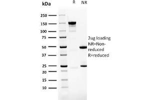 SDS-PAGE Analysis Purified PDZ and LIM Domain 1 Mouse Monoclonal Antibody (PDLIM-1).