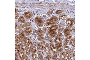 Immunohistochemical staining of human stomach with BET1L polyclonal antibody  shows strong granular cytoplasmic positivity in glandular cells.