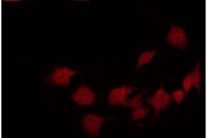 ABIN6267633 staining 293 by IF/ICC.