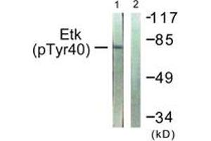 Western blot analysis of extracts from HepG2 cells, using ETK (Phospho-Tyr40) Antibody. (BMX anticorps  (pTyr40))