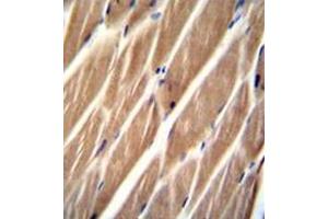 Immunohistochemistry analysis in formalin fixed and paraffin embedded human skeletal muscle reacted with PIP5KL1 Antibody (N-term) followed by peroxidase conjugation of the secondary antibody and DAB staining.