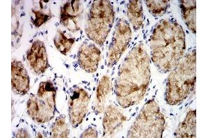Immunohistochemical analysis of paraffin-embedded stomach tissues using MUC5AC mouse mAb with DAB staining.