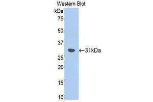 Western Blotting (WB) image for anti-Fascin (FSCN1) (AA 8-260) antibody (ABIN1174989)
