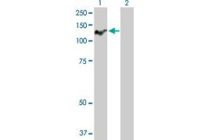 Western Blot analysis of ATP2C1 expression in transfected 293T cell line by ATP2C1 MaxPab polyclonal antibody. (ATP2C1 anticorps  (AA 1-919))