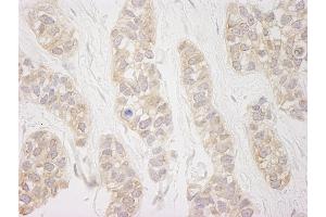 anti-DEAD (Asp-Glu-Ala-As) Box Polypeptide 19B (DDX19B) (C-Term) antibody