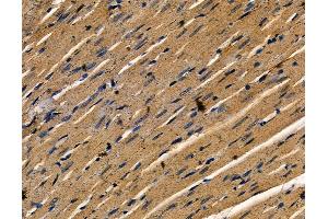 ABIN7094952 and ABIN7099008 at 1/100 staining rat heart tissue by IHC-P.