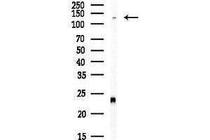 Western blot analysis of lysates from Hela cells(heat-shock, 45 min treatment), using IP Antibody at 1/1000 dilution.