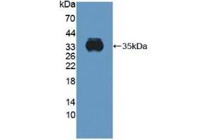 Detection of Recombinant CYBb, Human using Polyclonal Antibody to Cytochrome b-245 Beta Polypeptide (CYBb) (CYBB anticorps  (AA 283-570))