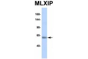 Host:  Rabbit  Target Name:  MLXIP  Sample Type:  Human Adult Placenta  Antibody Dilution:  1. (MLXIP anticorps  (Middle Region))