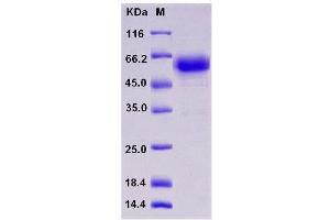 Western Blotting (WB) image for Tumor Necrosis Factor Receptor Superfamily, Member 1A (TNFRSF1A) (Active) protein (Fc Tag) (ABIN7321201)