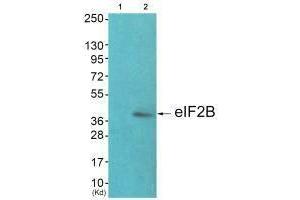 Western blot analysis of extracts from JK cells (Lane 2), using eIF2B (Ab-67) antiobdy.